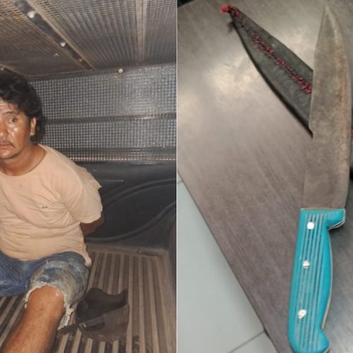 Ataque no Maranhão: Peça Metálica de Sutiã Evita Tragédia Após Mulher Ser Esfaqueada por Companheiro