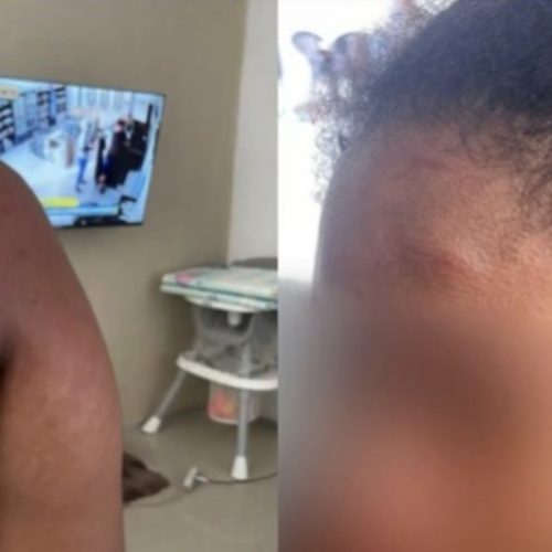 Grávida denuncia agressões brutais de ex-patroa no MA e diz que tentou proteger o bebê durante ataque