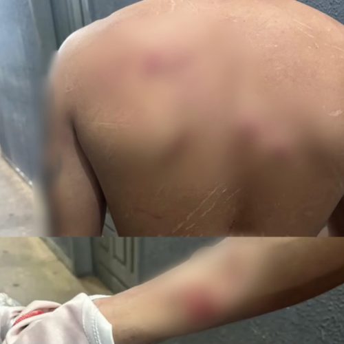 Pai fica ferido ao proteger bebê de 16 dias durante surto de violência doméstica em Imperatriz