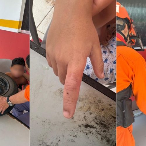 Menino de 5 anos é salvo após ficar com dedo preso em roda de veículo na capital maranhense
