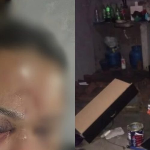 Mulher é Agredida por Companheiro Após Discussão em São José de Ribamar